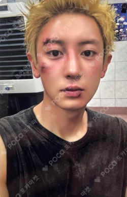 EXO チャニョル  QQ Music 中華 中国 starlight 星5 Pocamarket, EXO CHANYEOL Black Out QQ MUSIC K-pop Photocard